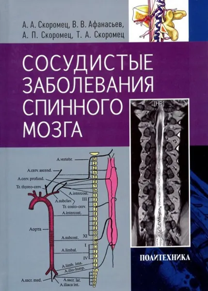 Обложка книги Сосудистые заболевания спинного мозга. Руководство для врачей, Скоромец Александр Анисимович, Афанасьев Василий Владимирович