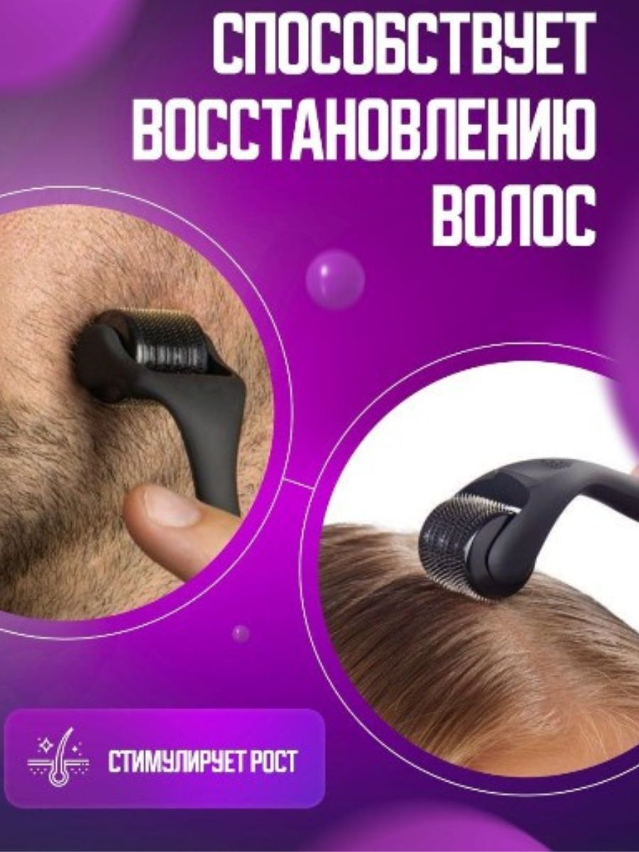 Мезороллер для бороды эффект. Ролер для бородв. Мезороллер для бороды 1мм. Дермароллер для бороды. 5 mm для бороды.