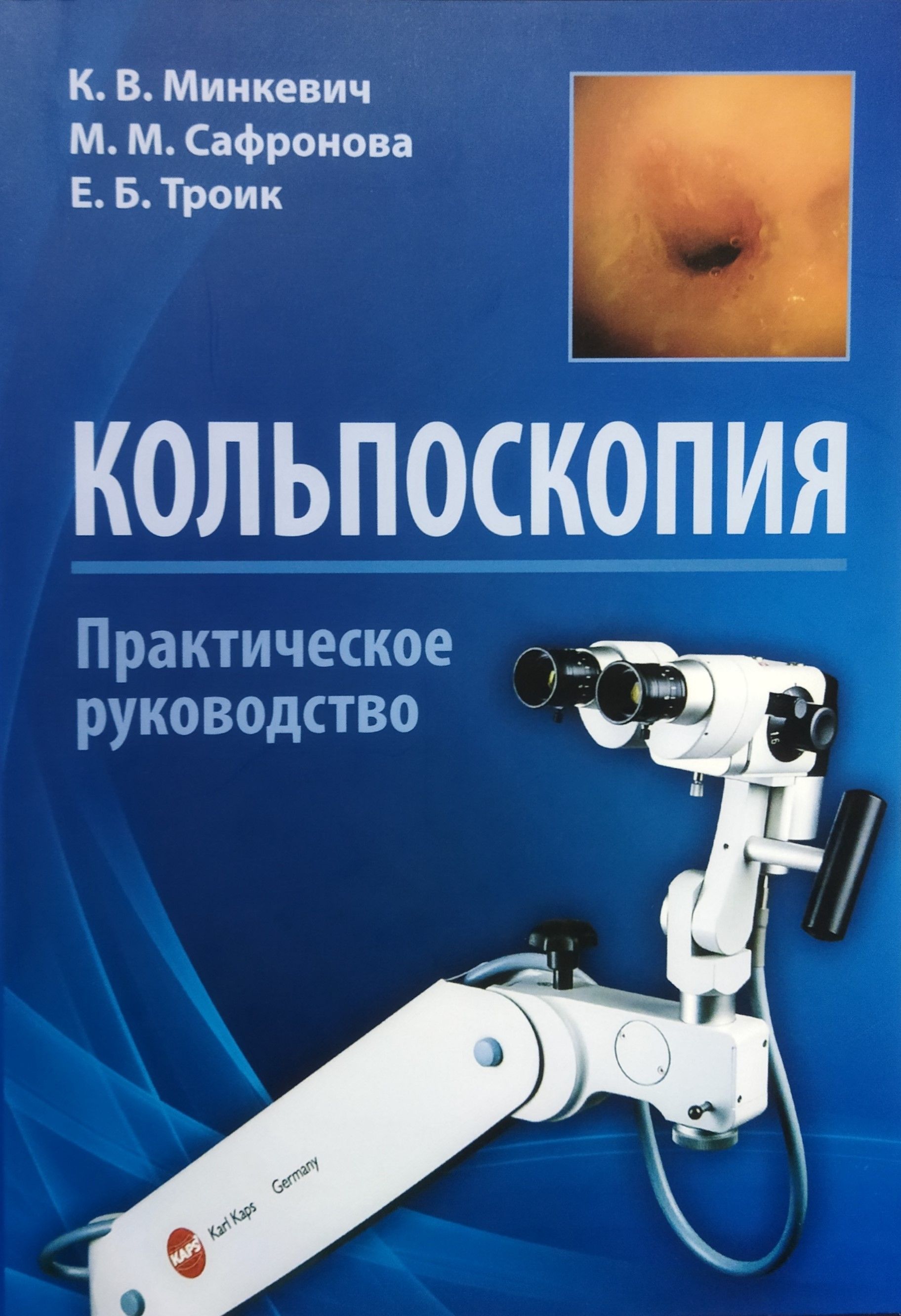 Минкевич