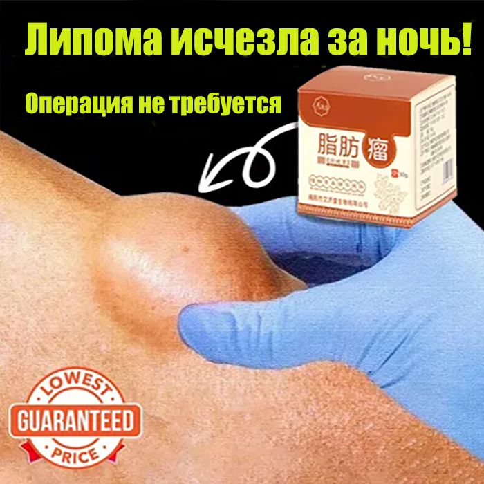 Кремдляудаленияподкожныхприпухлостейщитовиднаяжелезалипомы30г,показанприотечностикожи,целлюлите,фиброзномжировике