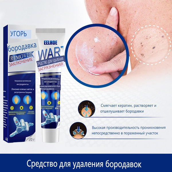 Крем для удаления бородавок на теле, гель для удаления пятен, крем для ...