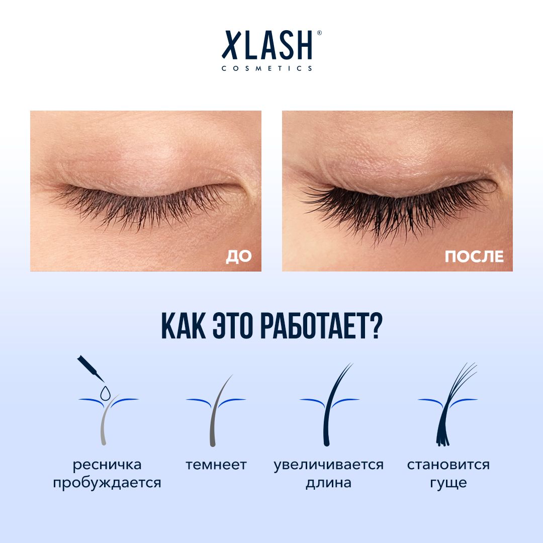 Xlash. Xlash сыворотка для роста ресниц. Xlash линейка для ресниц. Xlash до и после. Xlash логотип.