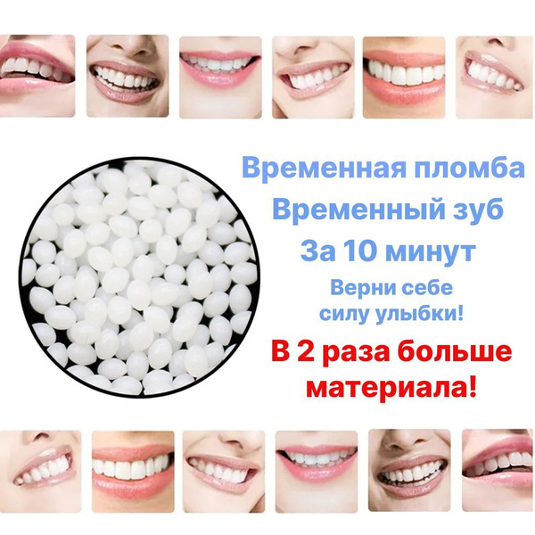 Выпала временная пломба: что делать? | Стоматология Smile-at-Once | Дзен