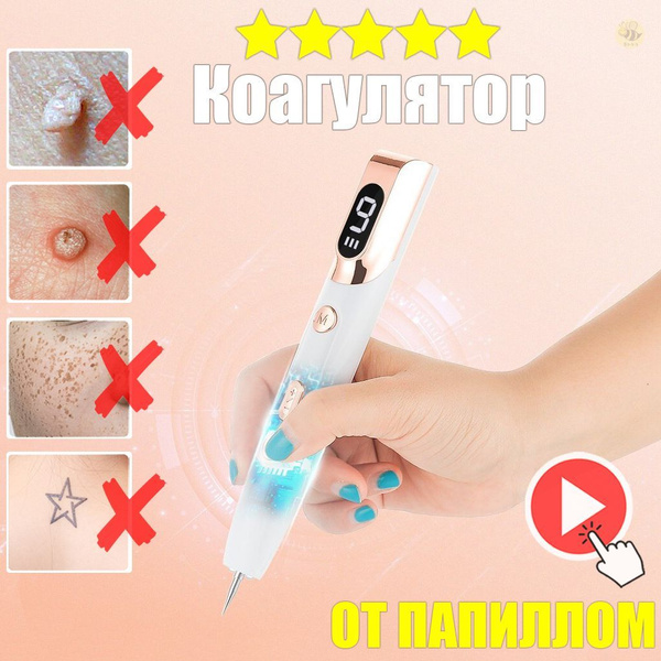 Характеристики Лазерная ручка от папиллом и бородавок / Плазменная ...