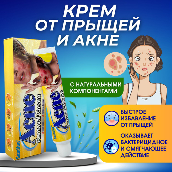 Крем от прыщей на лице мазь против акне - купить с доставкой по ...