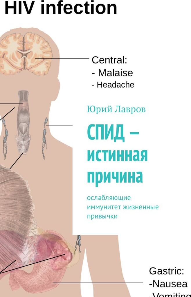 фото СПИД - истинная причина