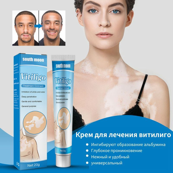 Мазь для лечения витилиго, Увлажняющий крем против пигментации кожи ...