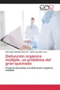 Disfuncion organica multiple, un problema del gran quemado - Martinez Barreto Elvira Maria, González León Adrian