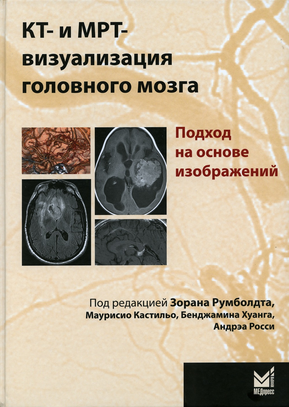 КТ- и МРТ-визуализация головного мозга. Подход на основе изображений -  купить с доставкой по выгодным ценам в интернет-магазине OZON (185507468)