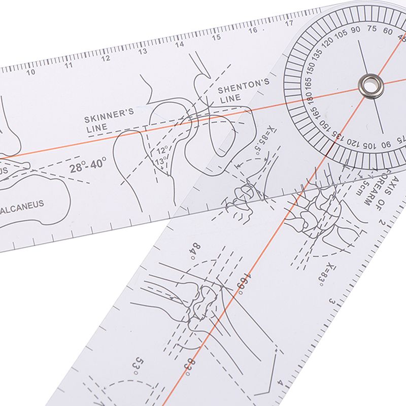 Медицинская ортопедическая линейка линейка для измерения суставов