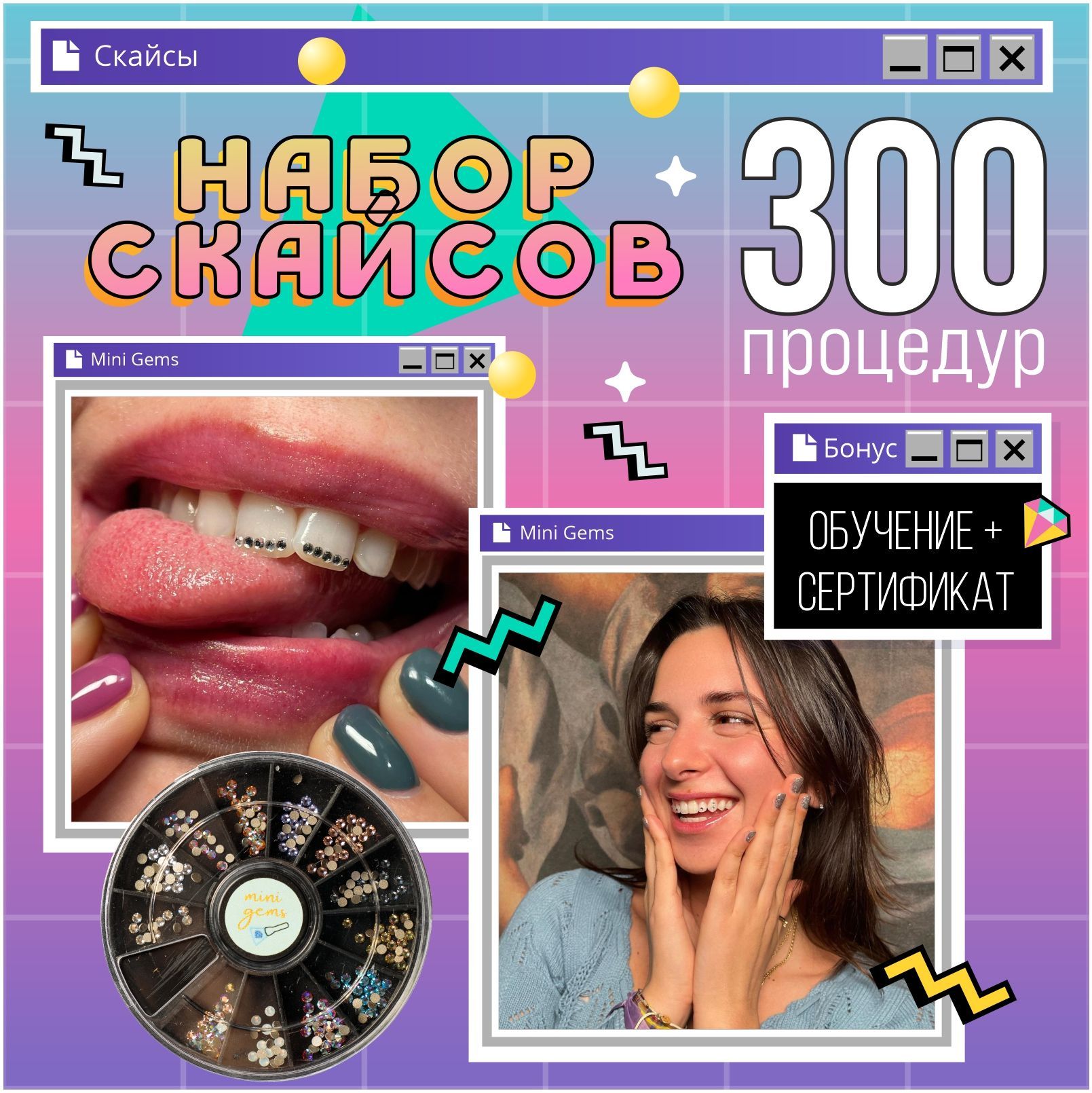 MY BRILLIANT SMILE Скайсы для зубов, 300шт