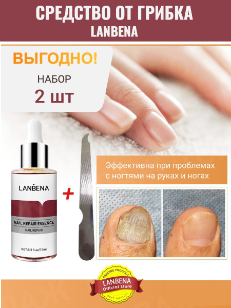 Средство от грибка ногтей на ногах LANBENA в наборе 2 шт / Уход за ...