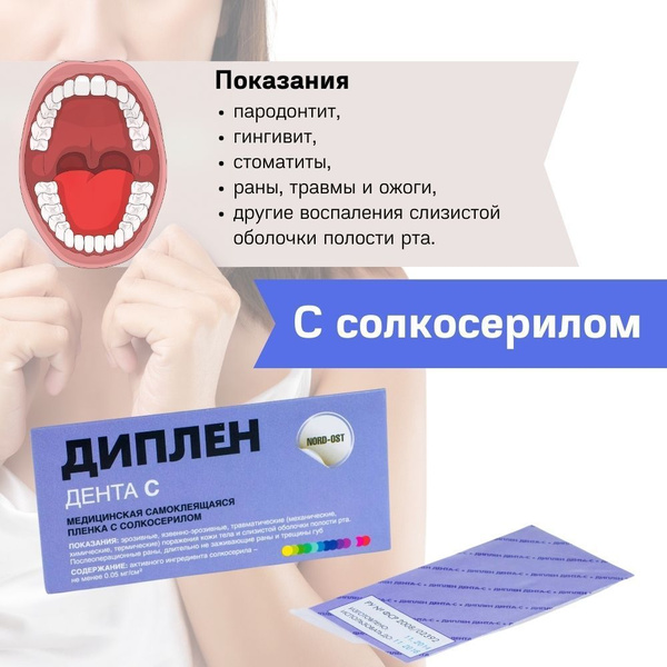 Диплен Дента С с солкосерилом - стоматологическая пленка самоклеящаяся ...