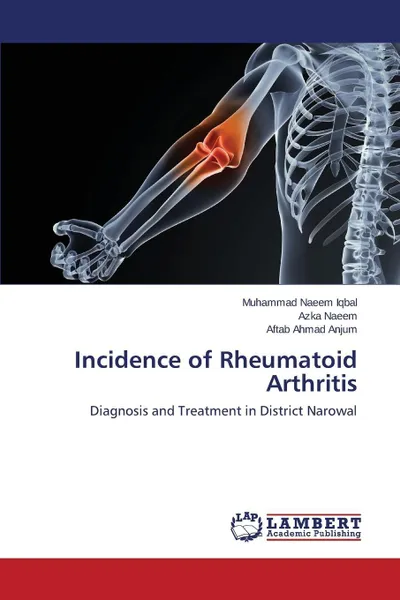 Обложка книги Incidence of Rheumatoid Arthritis, Iqbal Muhammad Naeem, Naeem Azka, Anjum Aftab Ahmad