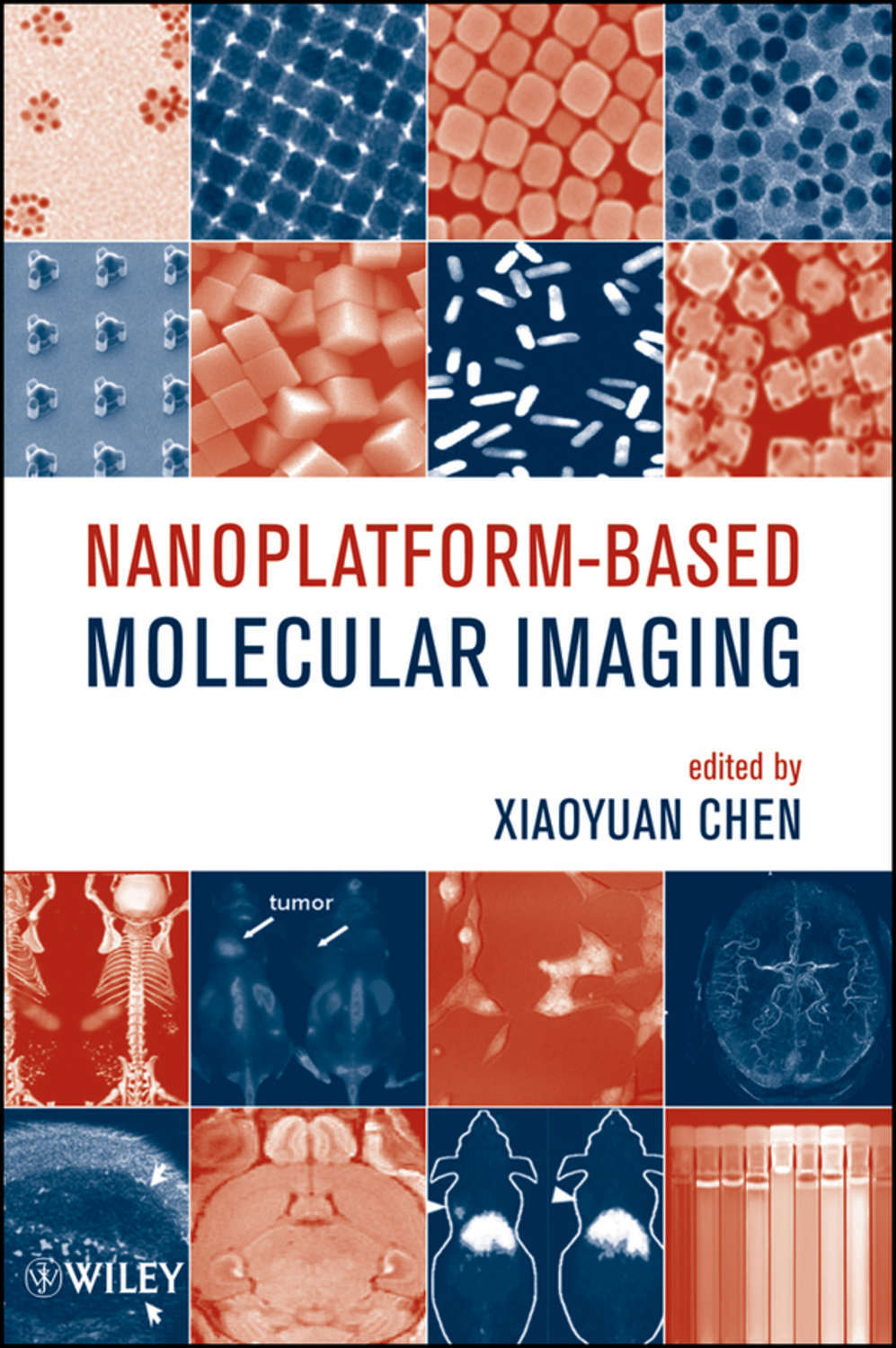 Molecular imaging. Molecular imaging