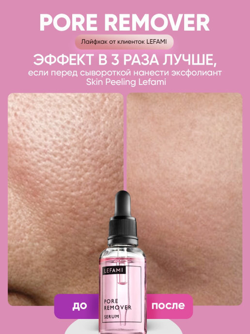 Lefami сыворотка. Skin peeling enzymatique Lefami. Lefami энзимный пилинг способ применения. Реклама сыворотки Lefami от АНАСТАСИЗ.