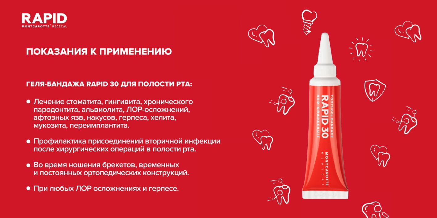 Ранозаживляющее средство Гель-бандаж для десен РАПИД 30, Монткаротт, M(图3)