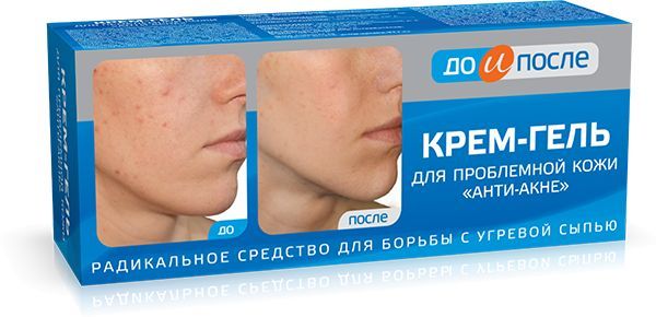 До и после мазь для лица Крем-гель для проблемной кожи Анти-Акне До и После, Твинс Тэк 50 мл. - купить с 