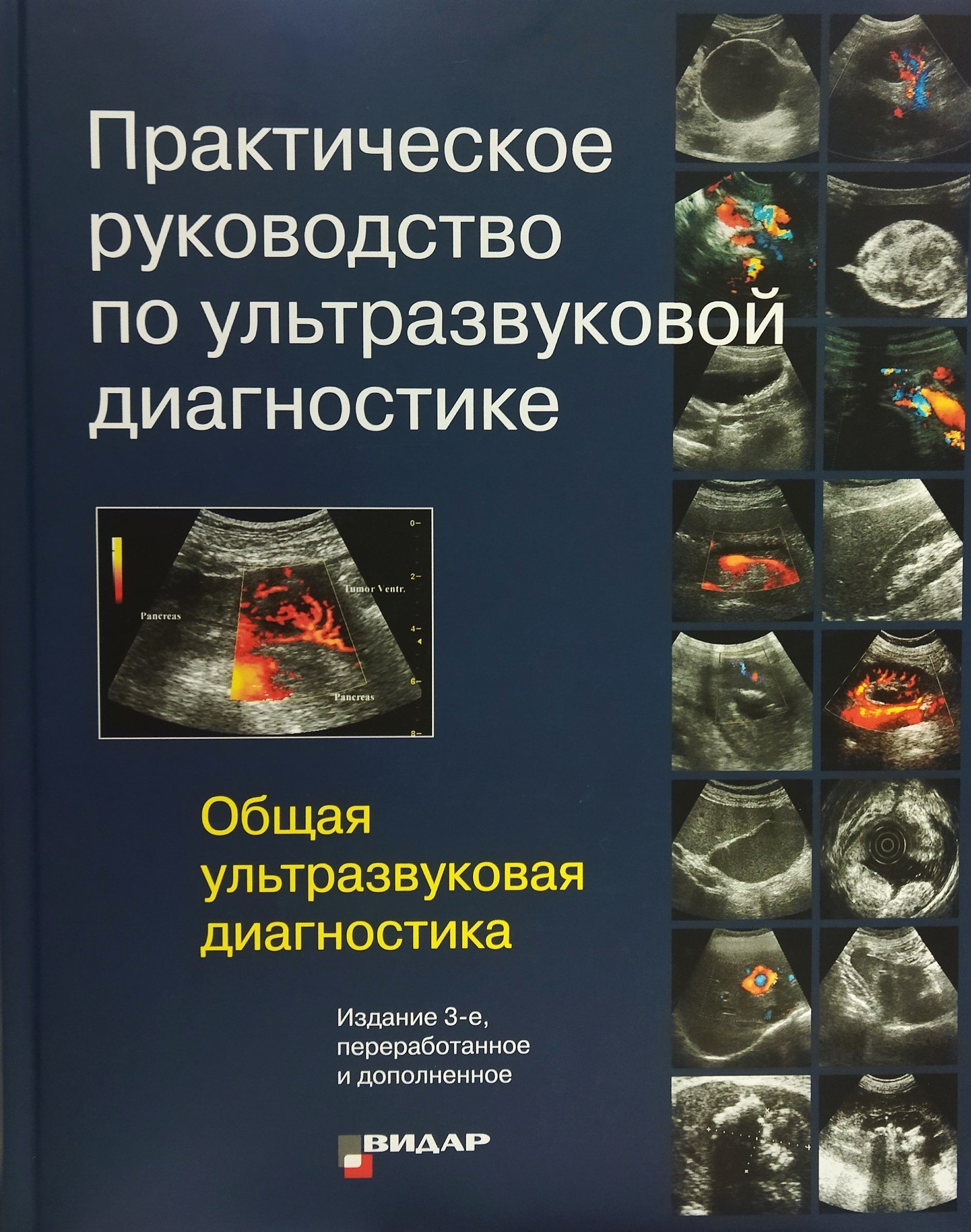 Митьков. Общая ультразвуковая диагностика. Практическое руководство. |  Митьков Владимир Вячеславович - купить с доставкой по выгодным ценам в  интернет-магазине OZON (1225845231)