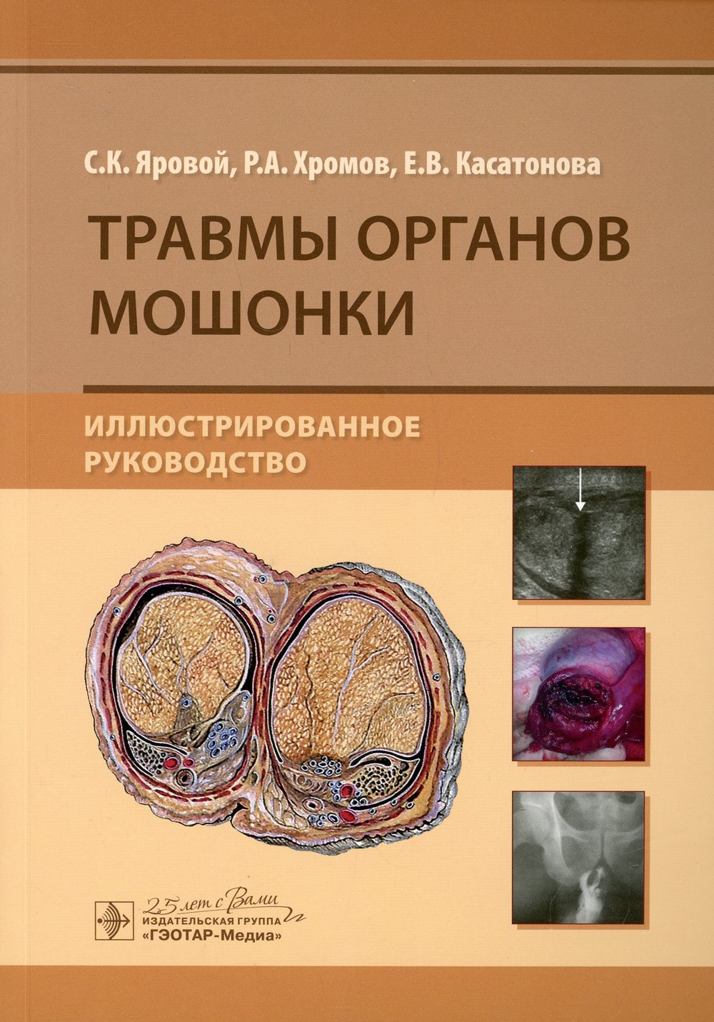 Купить Книгу Касатонова Китайский Синдром Путина