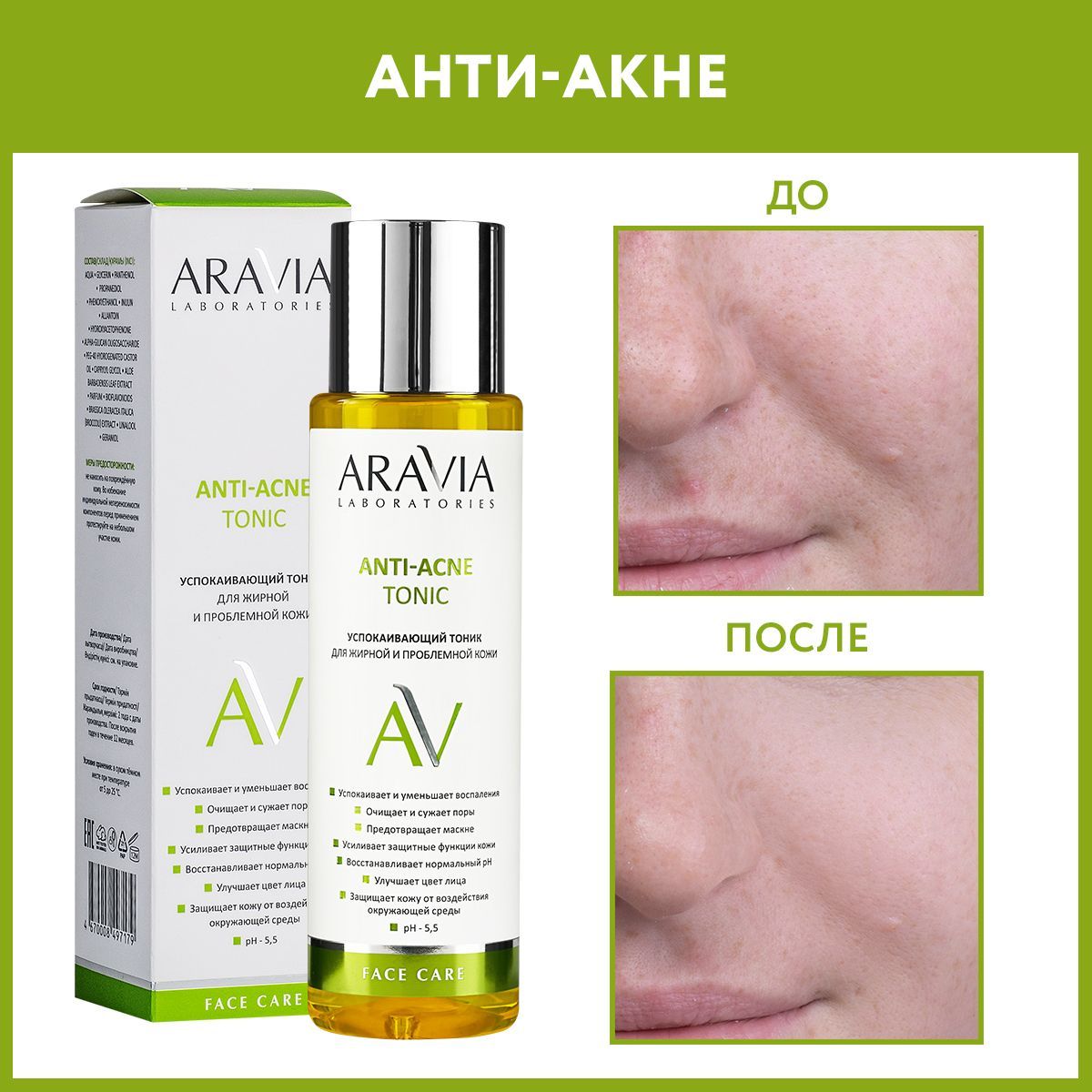 Aravia anti acne отзывы. Aravia Laboratories успокаивающий тоник для жирной и проблемной кожи Anti-acne Tonic. Aravia Laboratories Anti-acne Tonic отзывы.