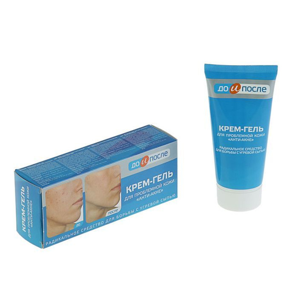 Крем-гель "До и После" Анти-Акне для проблемной кожи, 50 мл - купить с ...