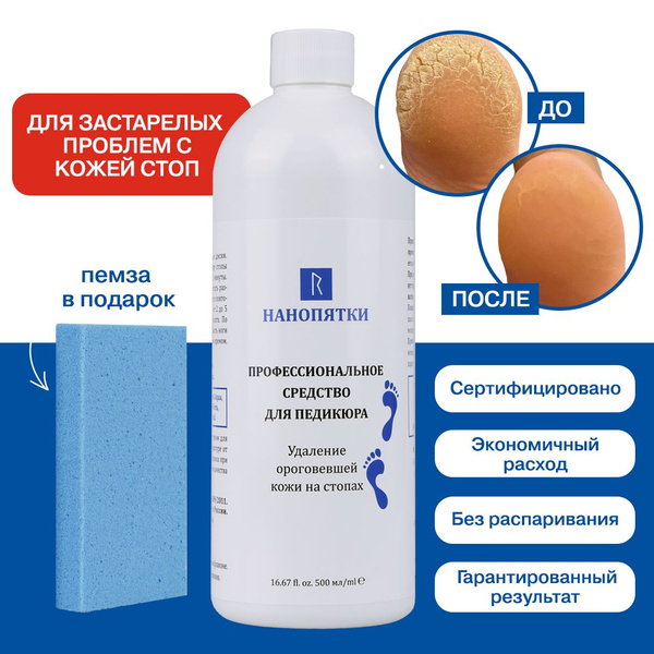 НАНОПЯТКИ / Косметика для ног. Подарочный набор для женщин. Кератолитик ...