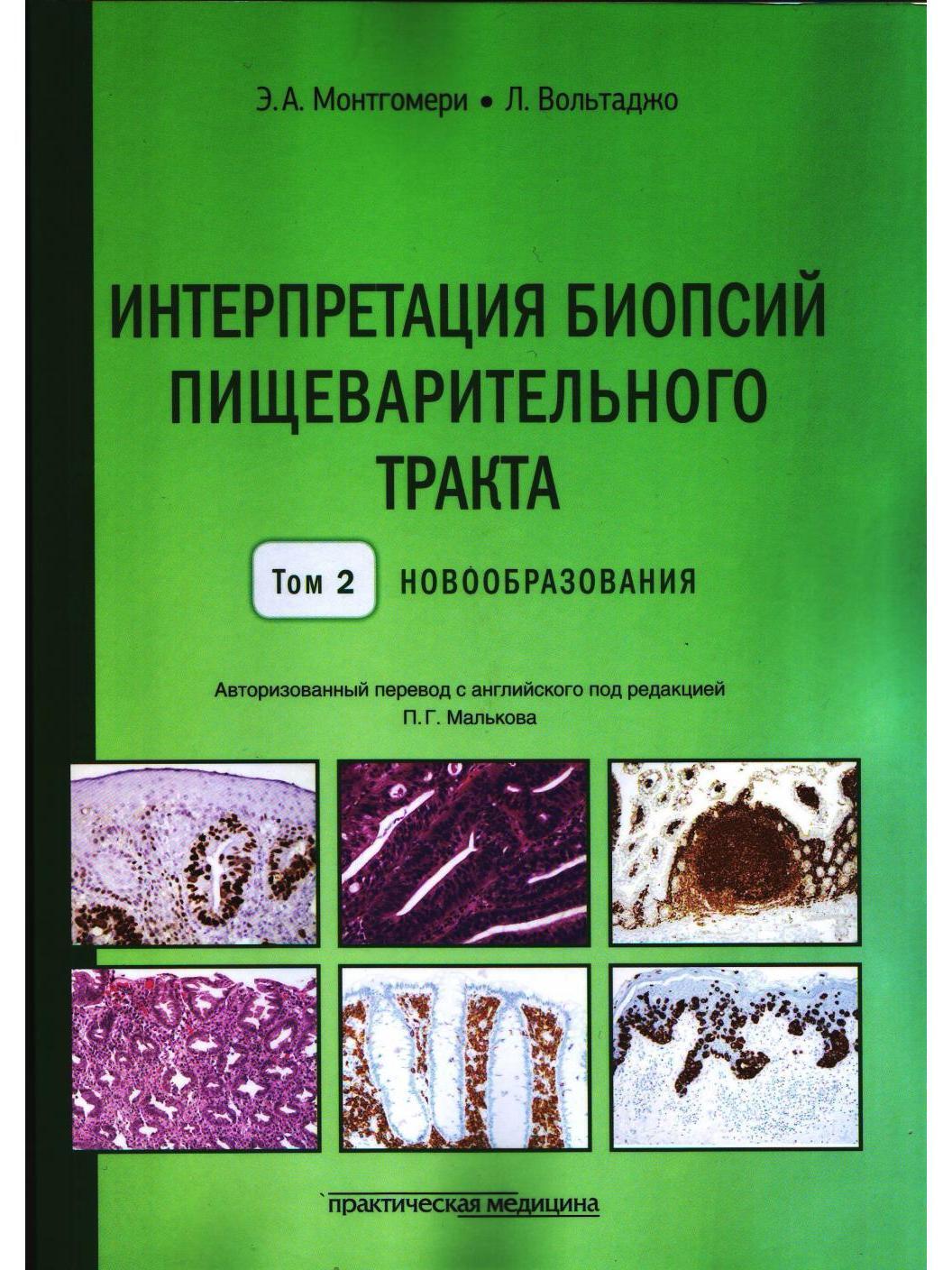 Интерпретация биопсий пищеварительного тракта.  Том 2. Новообразования.