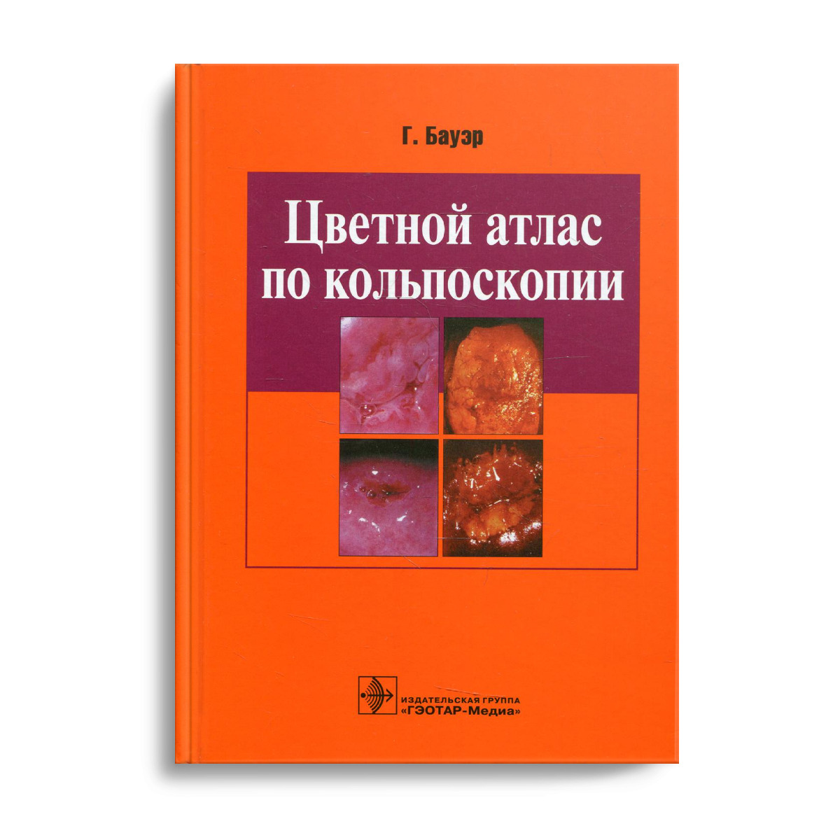 Цветной атлас по кольпоскопии | Бауэр Ганскурт - купить с доставкой по  выгодным ценам в интернет-магазине OZON (515448123)