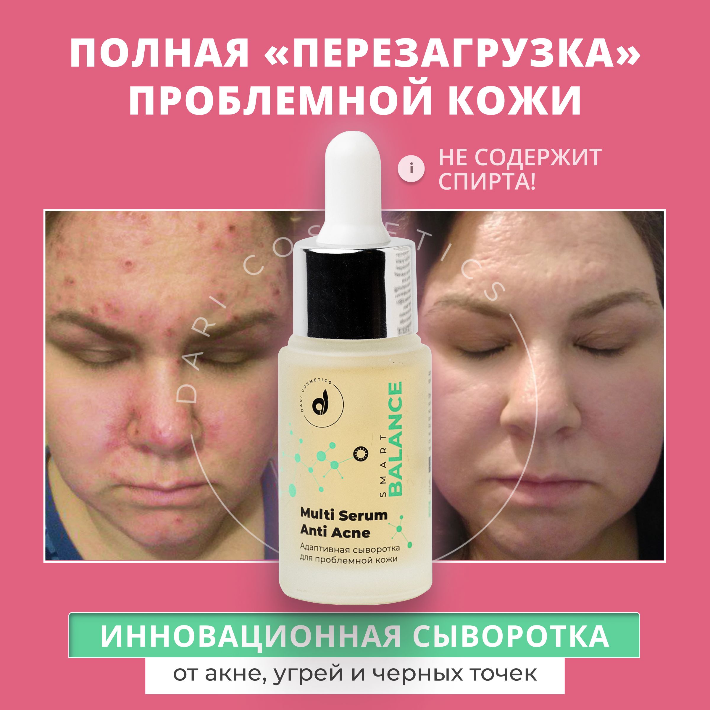 Dari cosmetics Сыворотка для лица восстанавливающая против прыщей с  гиалуроновой кислотой, уход для проблемной жирной кожи мужчин и женщин от  акне, постакне, черных точек, угрей и пигментных пятен - купить с доставкой