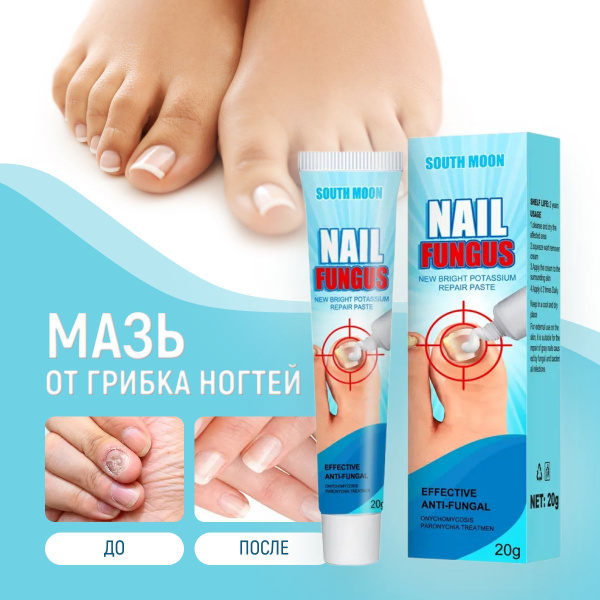 Мазь от грибка ногтей, 20 г. - купить с доставкой по выгодным ценам в ...