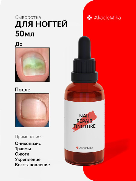 Сыворотка для ногтей стоп онихолизис Nail Repair Tincture , 50 мл ...