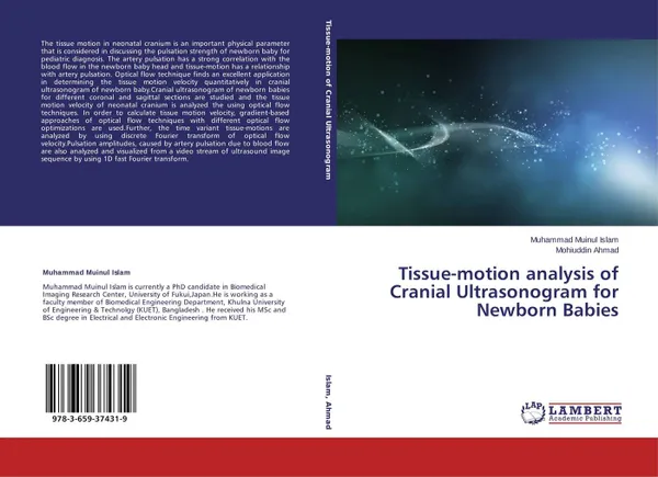 Обложка книги Tissue-motion analysis of Cranial Ultrasonogram for Newborn Babies, Muhammad Muinul Islam and Mohiuddin Ahmad