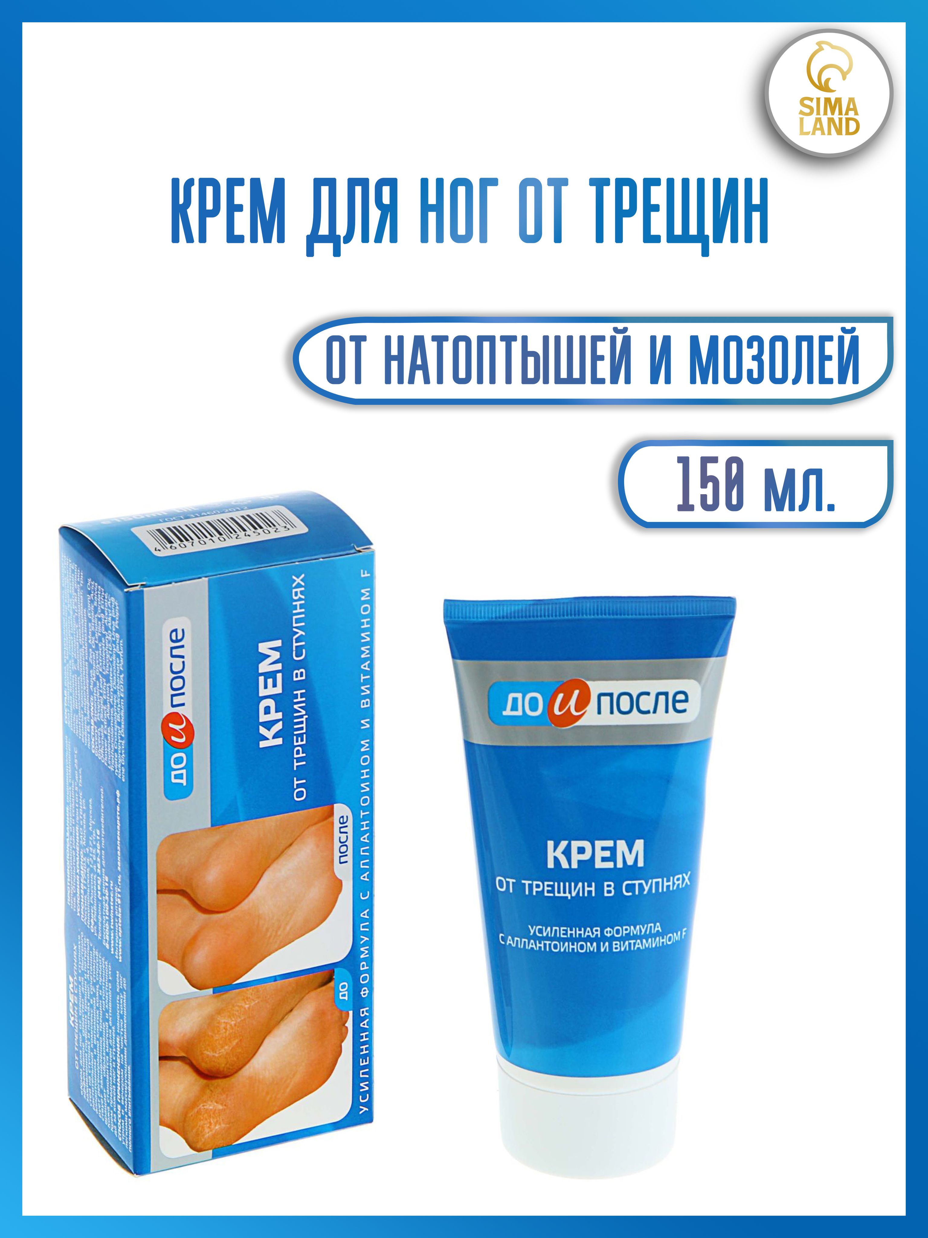 Крем от трещин на ногах. Крем и гель для пяток. Увлажняющий крем для пяток. Крем от трещин на ногах. Lipidro creme gehwol 500.