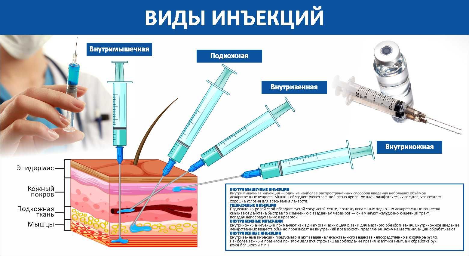 Презентация на тему виды инъекций