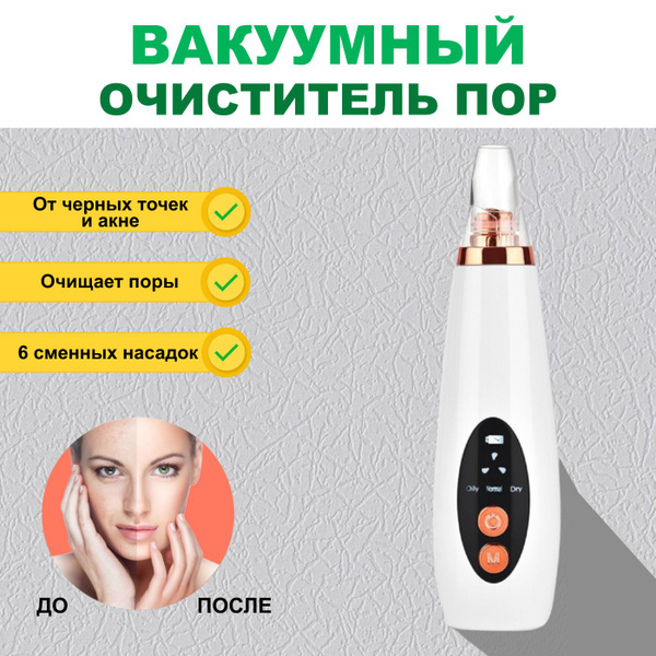 Вакуумный очиститель пор для лица от черных точек, прыщей купить на ...