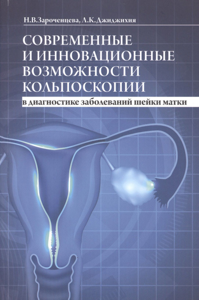 Современные и инновационные возможности кольпоскопии в диагностике ...