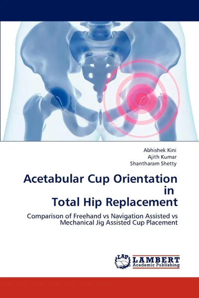 Обложка книги Acetabular Cup Orientation in Total Hip Replacement, Abhishek Kini, Ajith Kumar, Shantharam Shetty