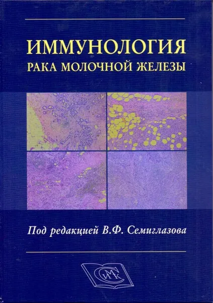 Обложка книги Иммунология рака молочной железы, Семиглазов Владимир Федорович