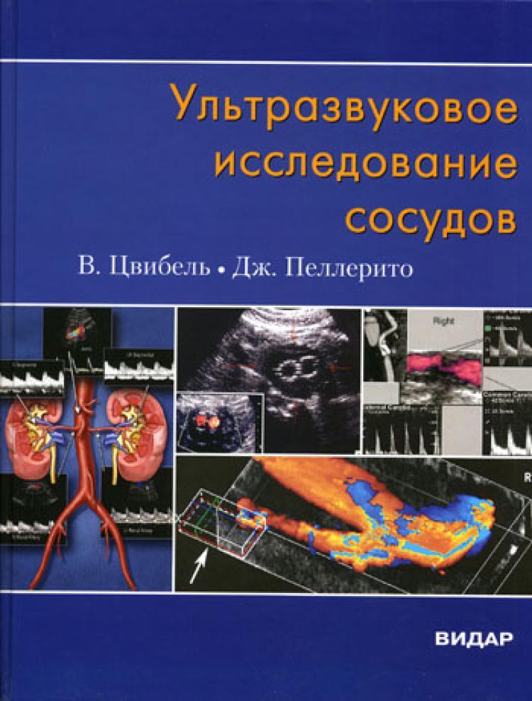 Ультразвуковое исследование сосудов. 5-е изд | Цвибель Вильям Дж., Пеллерито Джон С.