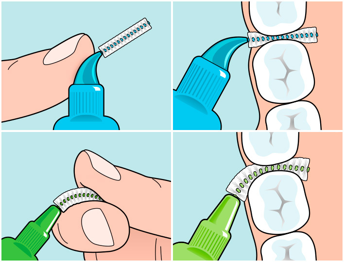 силиконовые ершики для зубов