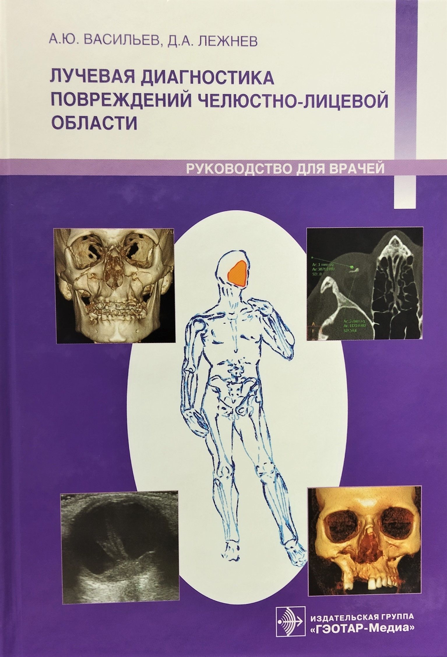 лучевая диагностика травм челюстно лицевой области. рентген перелом челюстно лицевой области. васильев а ю лучевая диагностика. лучевая диагностика чло. перелом верхней челюсти лучевая диагностика.