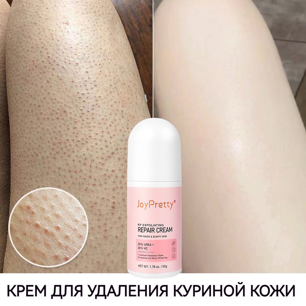 От Кератоза Кожи купить на OZON по низкой цене