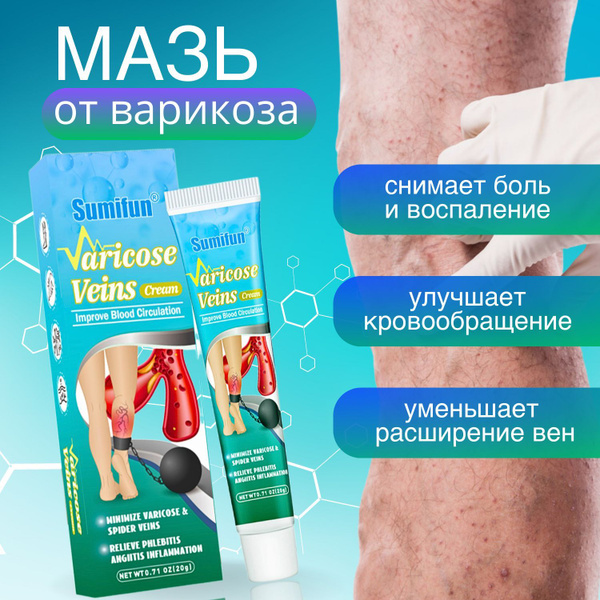 Китайская травяная мазь от варикоза вен против отеков и усталости ...