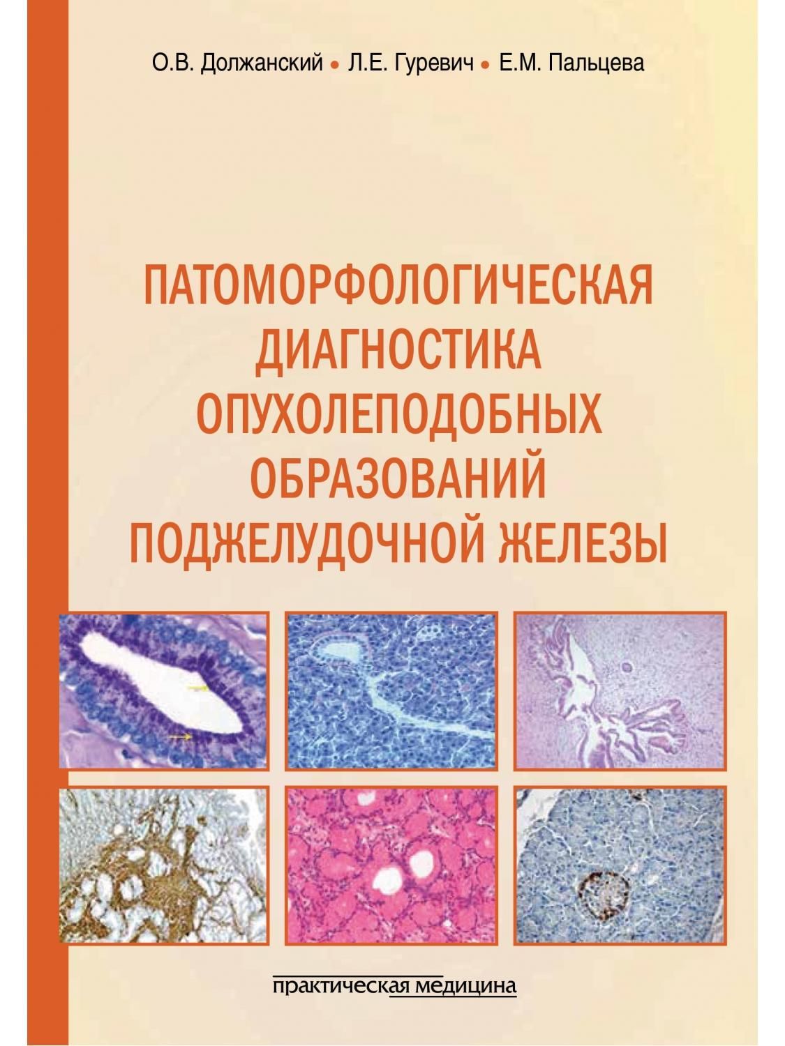 Патоморфологическая диагностика опухолеподобных образований поджелудочной  железы. Руководство для врачей | Должанский Олег Владимирович - купить с  доставкой по выгодным ценам в интернет-магазине OZON (711179052)