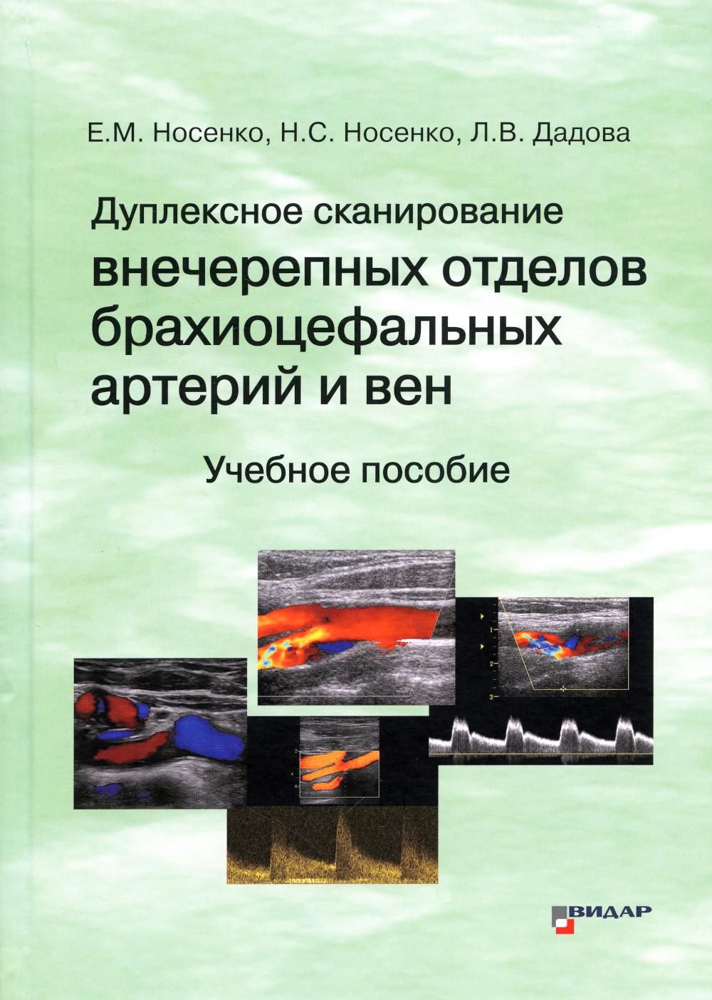 Дуплексное сканирование внечерепных отделов брахиоцефальных артерий и вен:  Учебное пособие