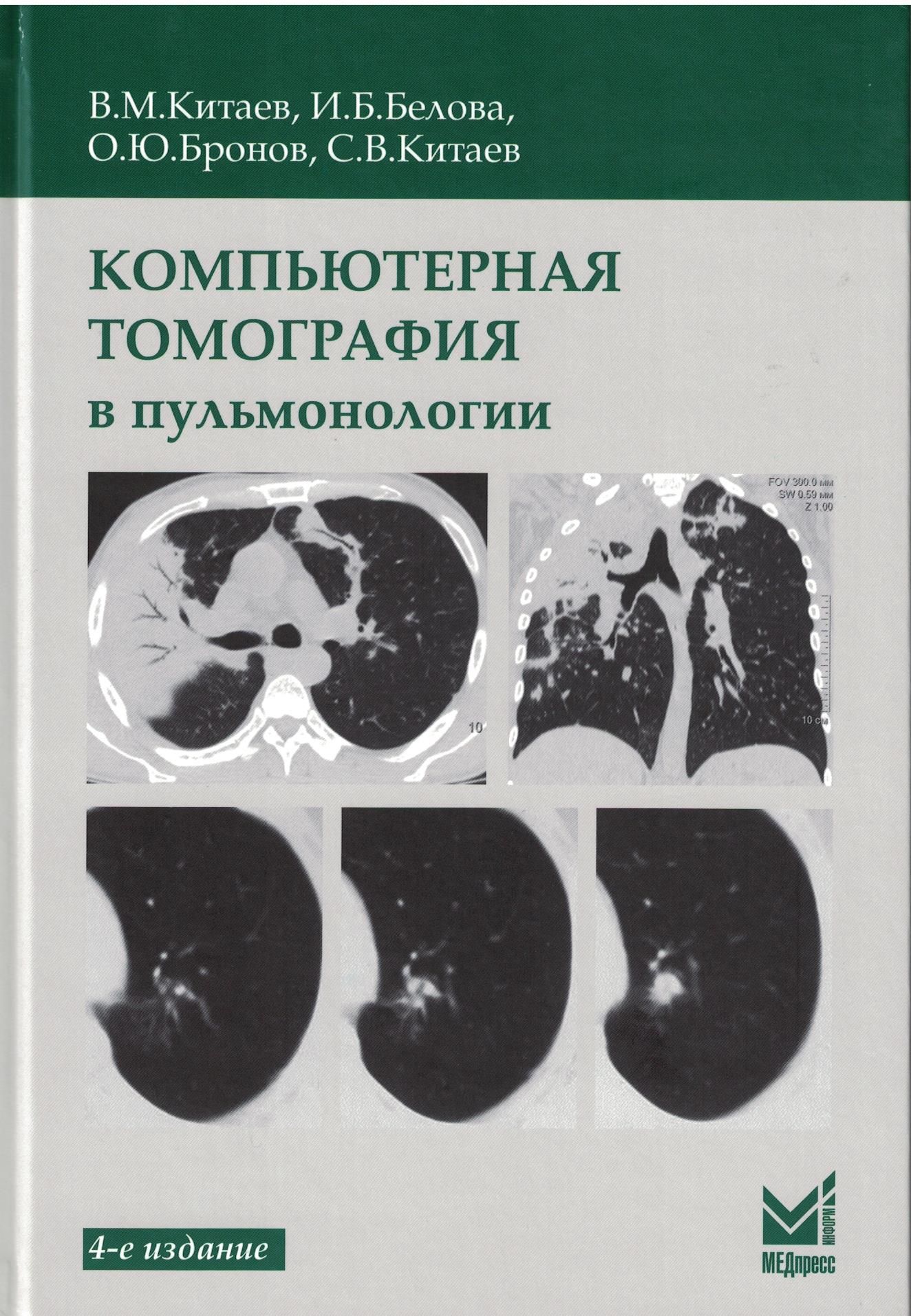 Ghj rn. Матиас Прокоп компьютерная томография. Книги по компьютерной томографии. Компьютерная томография в пульмонологии. Книги по кт диагностике.