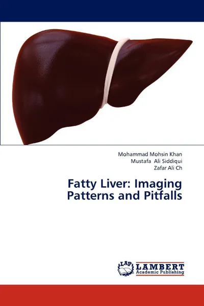 Обложка книги Fatty Liver. Imaging Patterns and Pitfalls, Mohsin Khan Mohammad, Ali Siddiqui Mustafa, Ali Ch Zafar