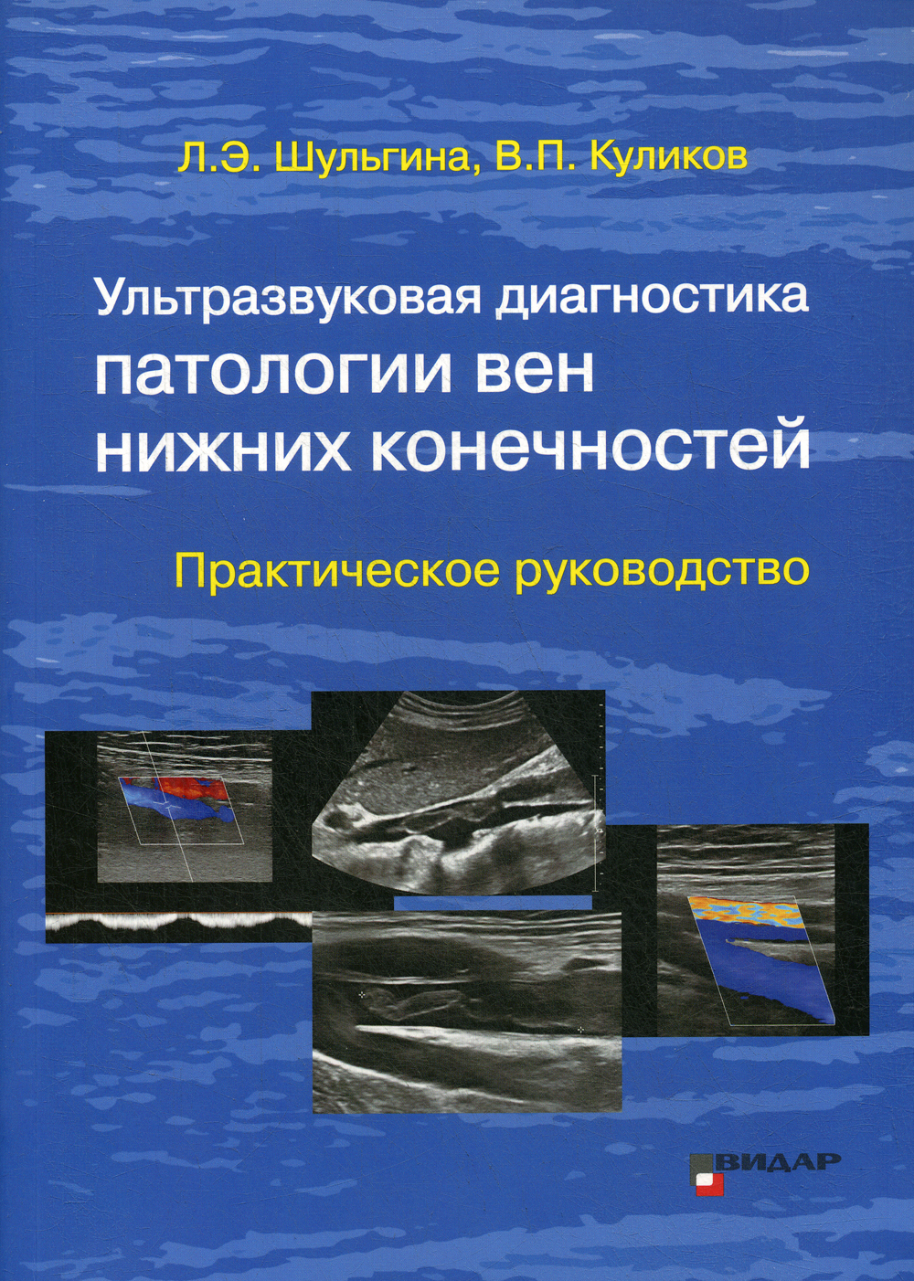 Ультразвуковая диагностика патологии вен нижних конечностей: практическое  руководство | Куликов Владимир Павлович - купить с доставкой по выгодным  ценам в интернет-магазине OZON (372430123)