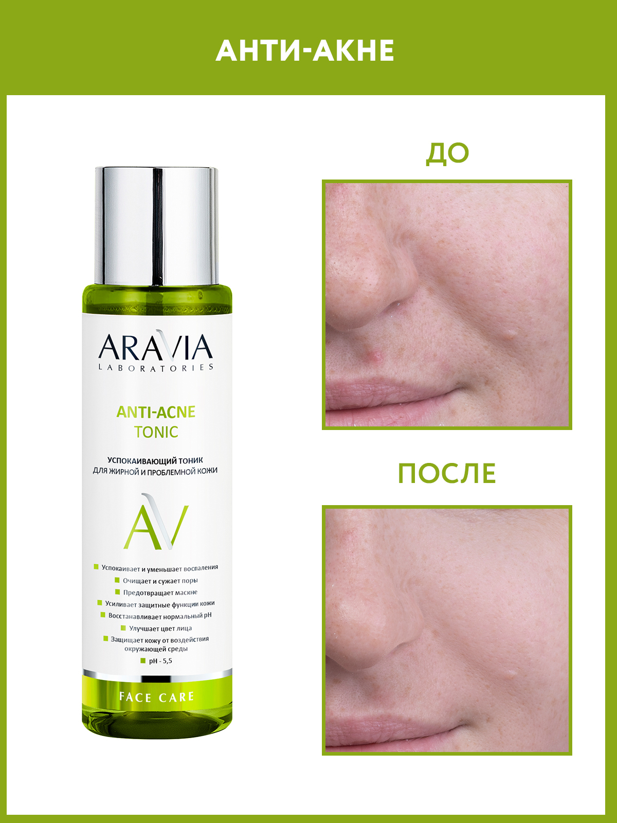 Аравия тоник для жирной кожи. Аравия тоник Anti-acne Tonic. Успокаивающий тоник для жирной и проблемной кожи Anti-acne Tonic, 250 мл. Aravia тоник Anti acne. Aravia тоник для жирной и проблемной кожи 250мл.